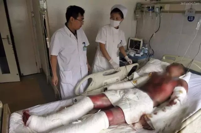 云顶yd2223线路检测